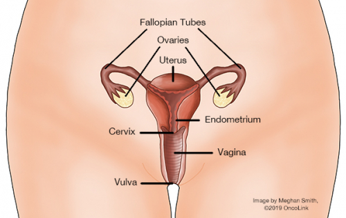 Genetic cancer of the womb - Extinderea venelor endometriale